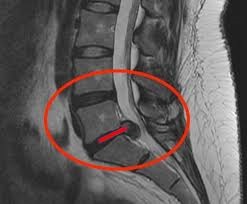 Dr. Aléssio Novais | Fisioterapeuta